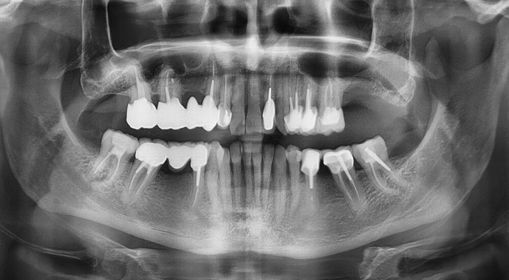 c0489fc3b6c2605489fc3b6c2f8489v___cr2