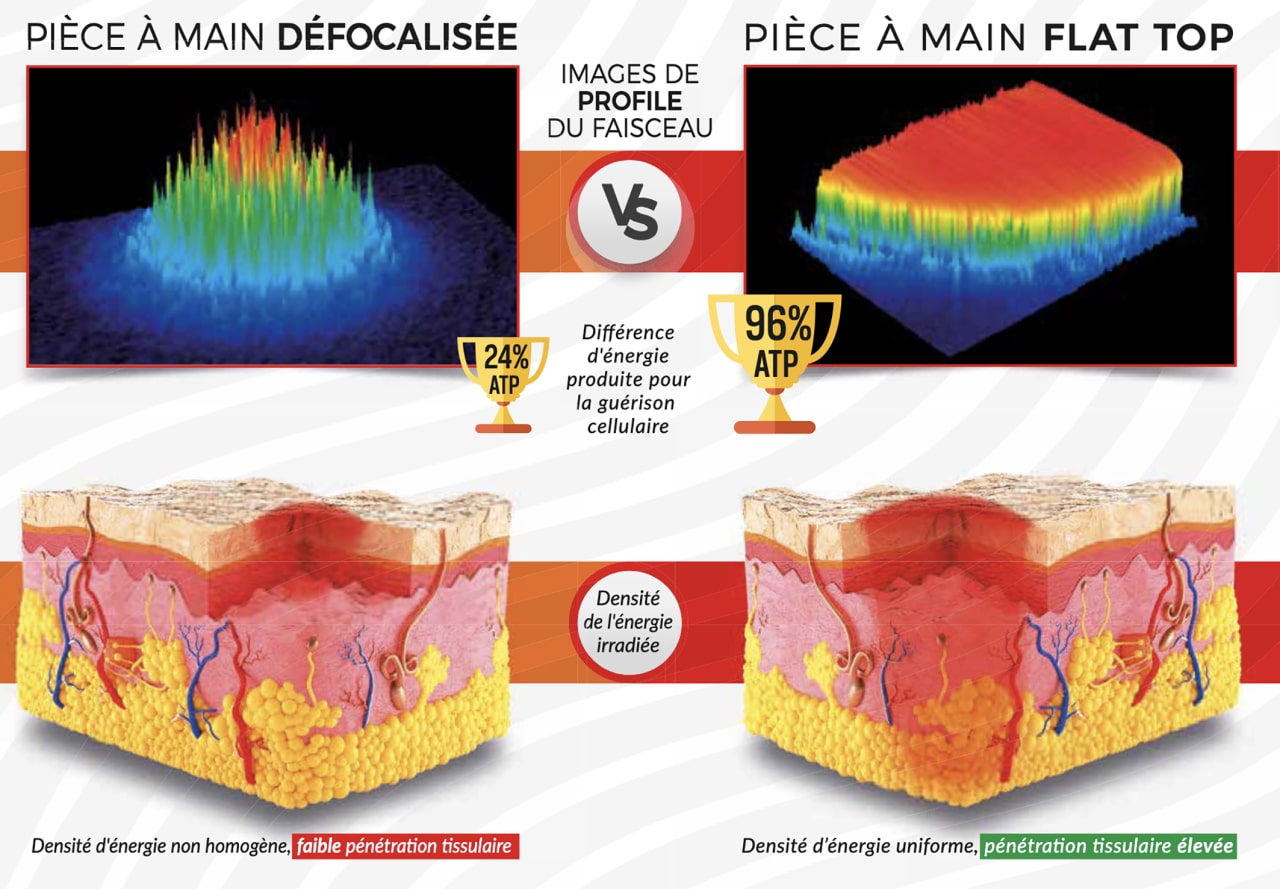 Fig.4 : Synthèse d'ATP par la Flat Top.