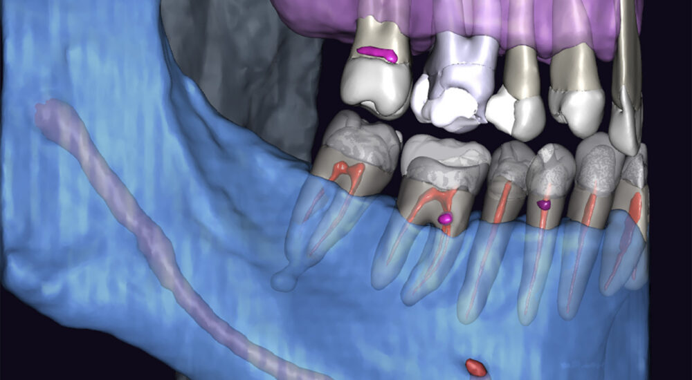 Les nouvelles technologies dans la prise en charge de cas complexes en endodontie