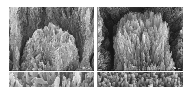 Images de microscopie électronique d’une dent avec de l’émail déminéralisé.faire repousser les dents