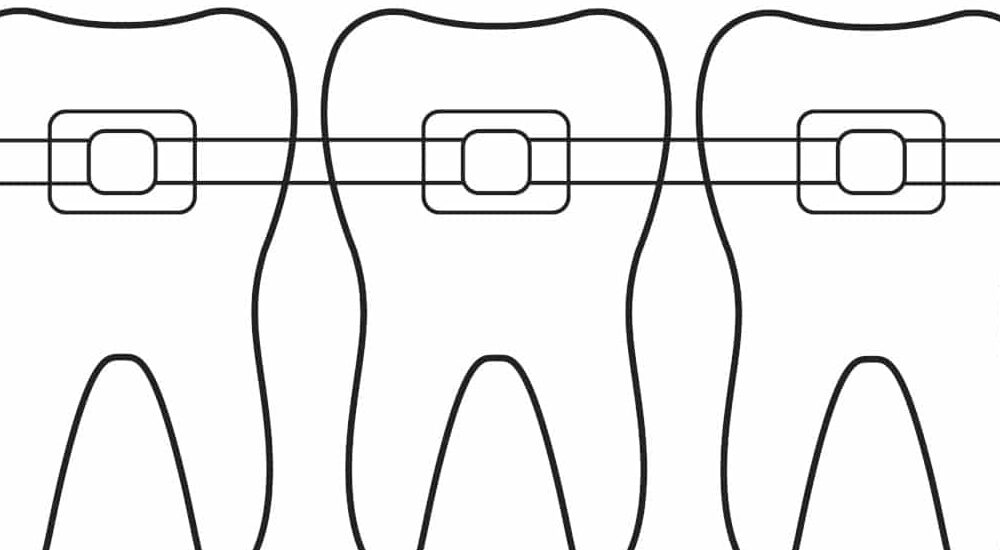 collage indirect numérique