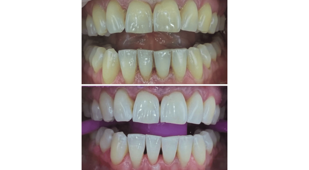 c392392ab8f86f792392ab8f81c923v cr2