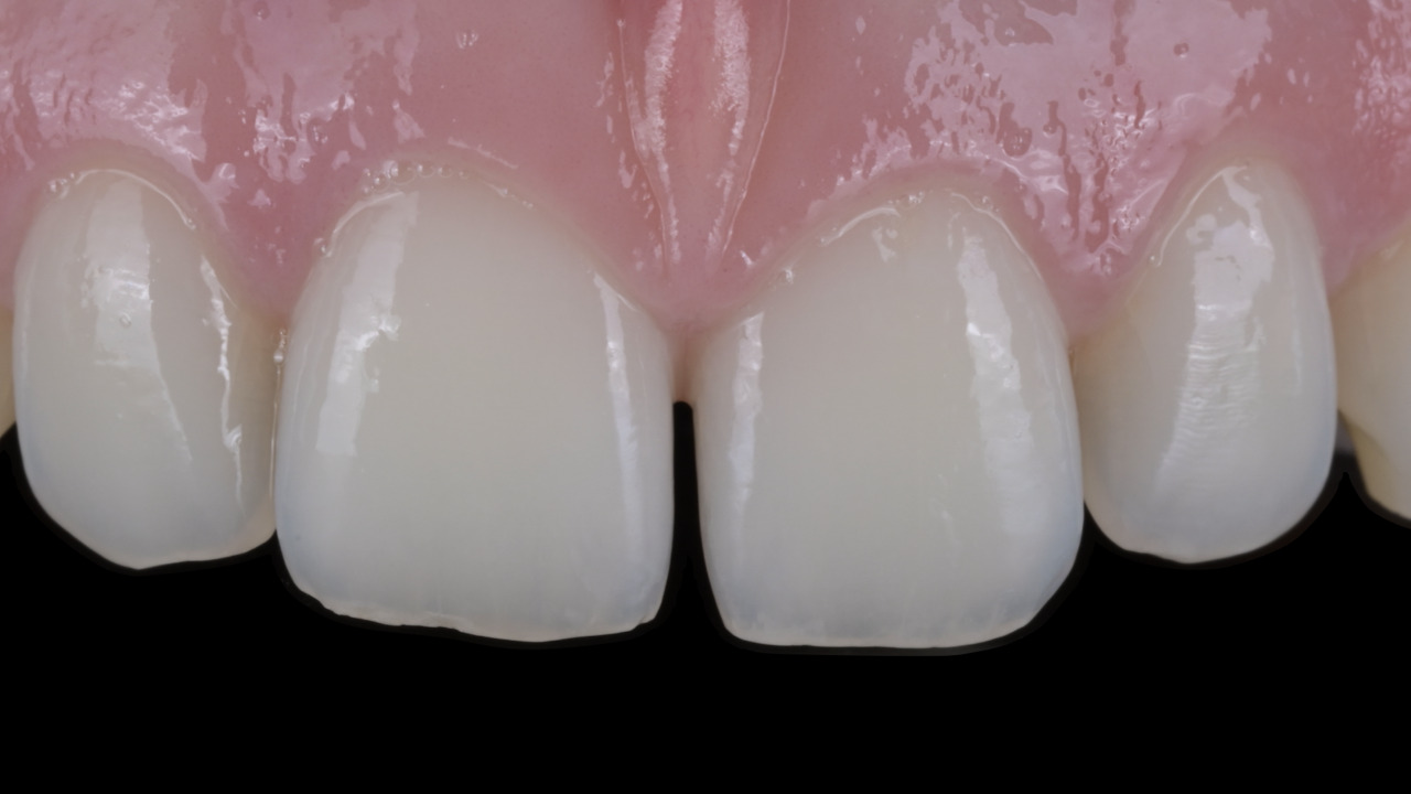 dee80042a0096c2f80042a00996f80v cr2