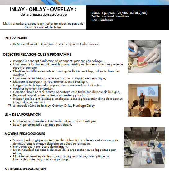 Inlay, Onlay, Overlay
