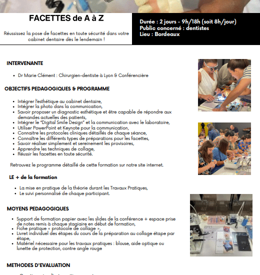 Les Facettes de A à Z