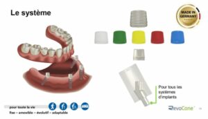 revocone doc 2 page 0001