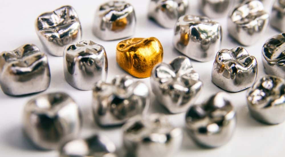 Couronnes dentaires en or et en métal. Cobalt dans les dispositifs médicaux