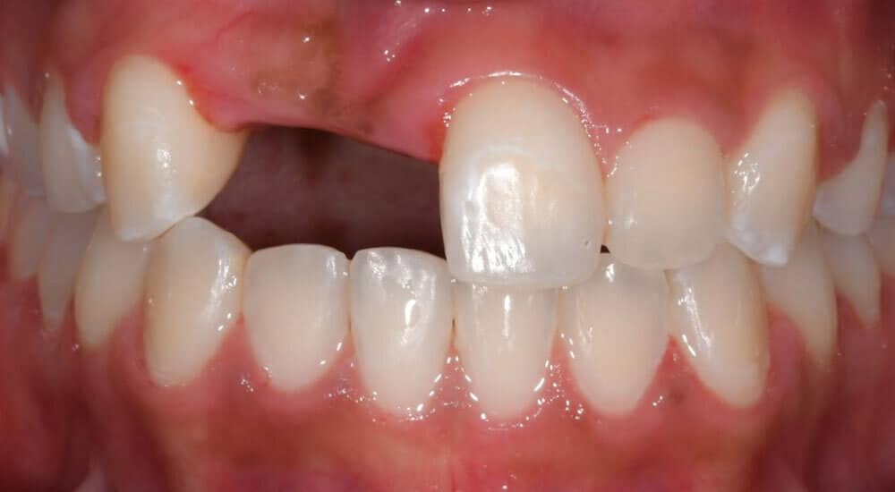 Trucs & astuces 