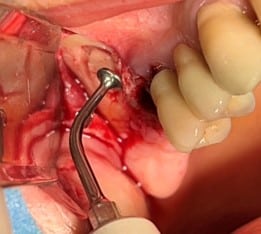 surgery training 3