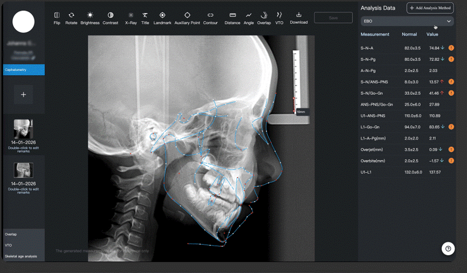 custom cephalometric analysis