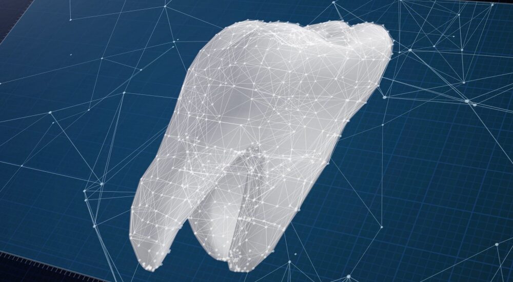 L&rsquo;IA en planification orthodontique 