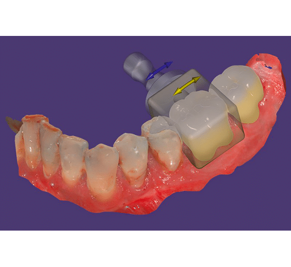licence exocad chairside cad core version