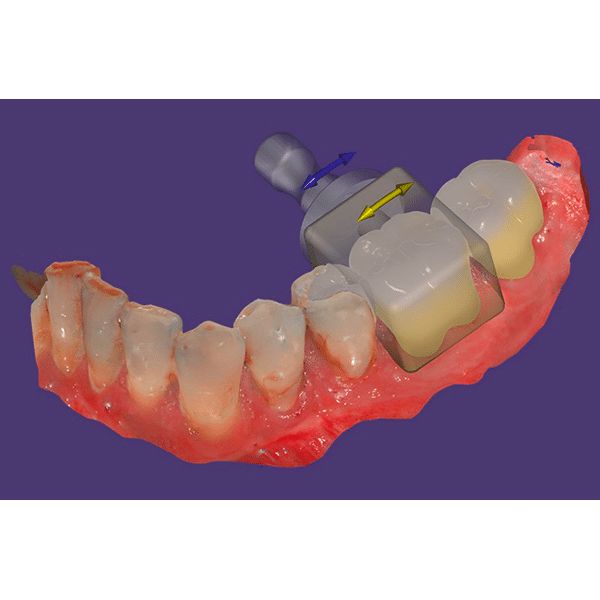 licence exocad chairside cad core version
