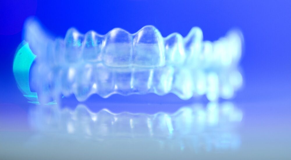 L’orthodontie au service de la dentisterie esthétique minimalement invasive