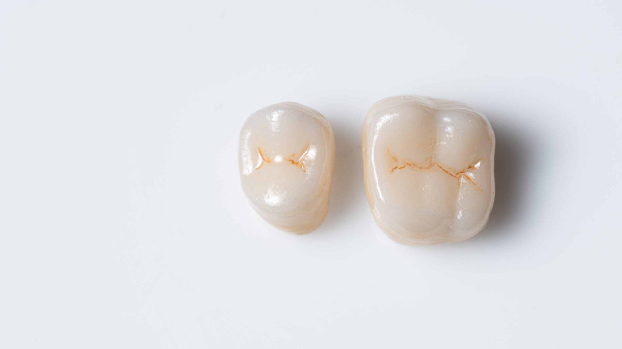 outside,of,dental,crown,beautiful,tooth,structure