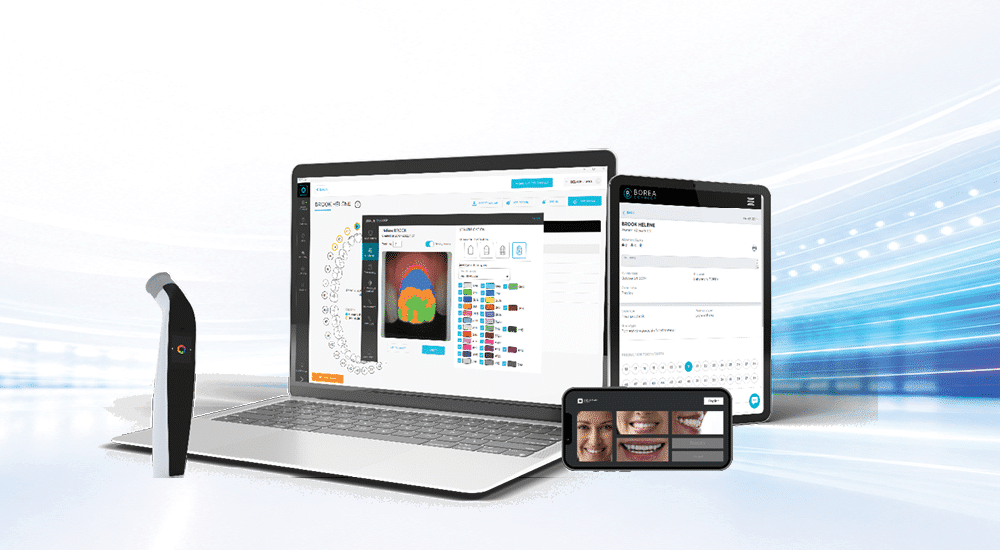 Cobra Shade Scan : La dernière étape pour une prothèse 100% numérique
