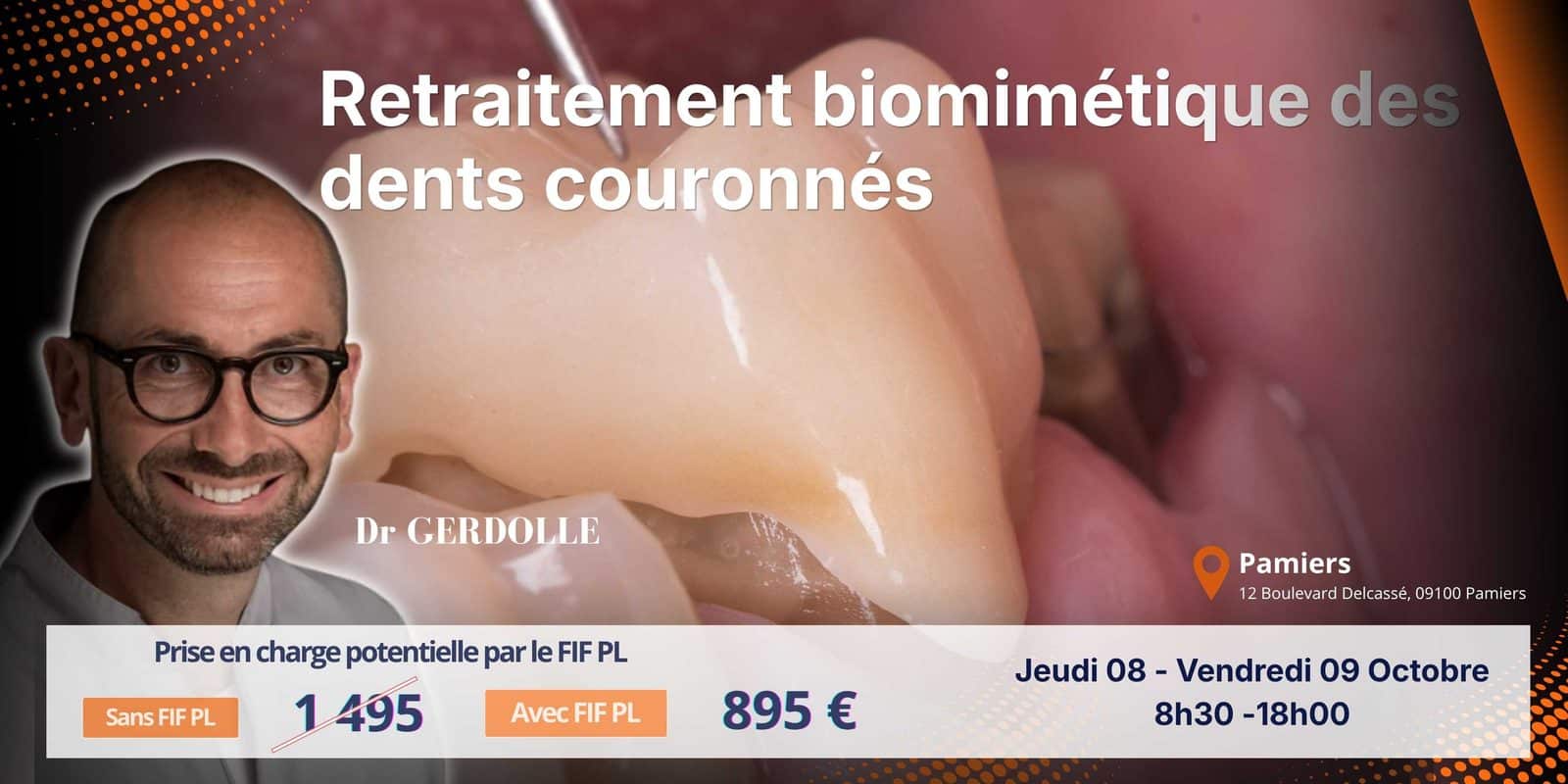 Retraitement biomimétique des dents couronnées Capsule