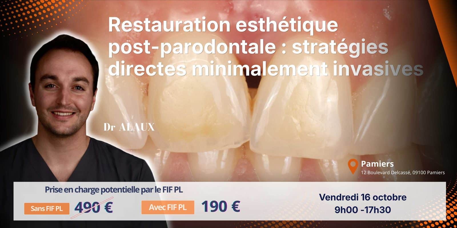 Restauration esthétique post-parodontale Capsule