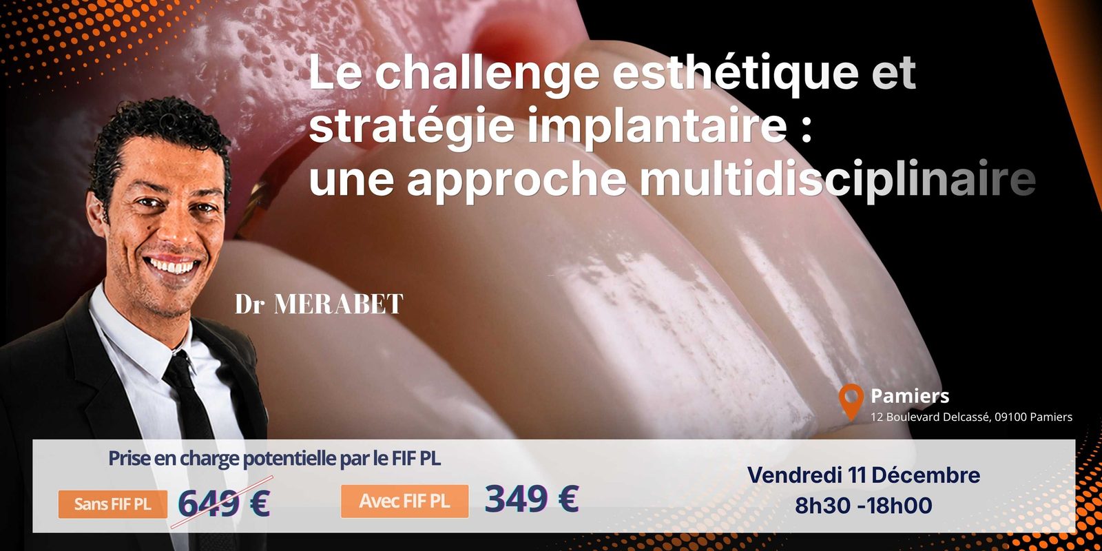Challenge esthétique et stratégie implantaire Capsule