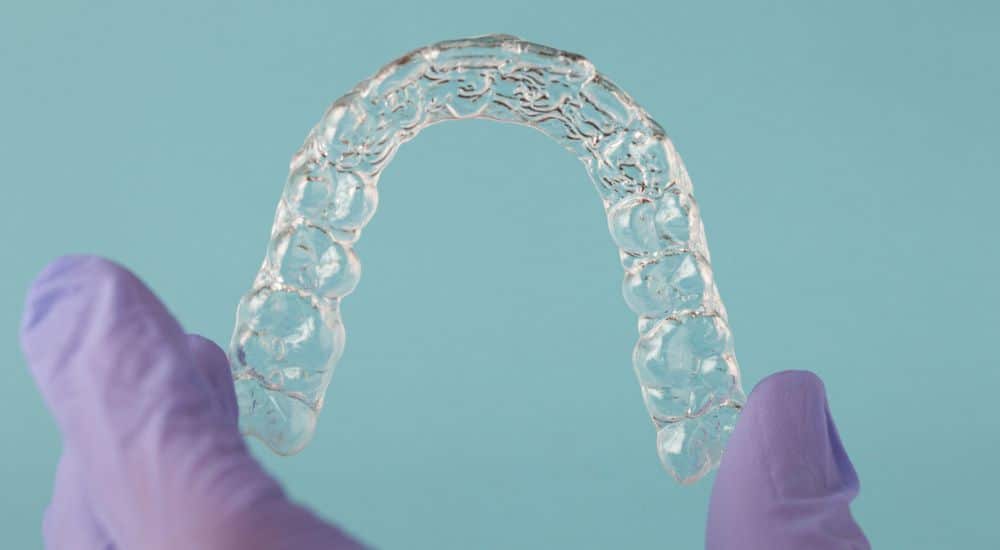 Gros plan sur un aligneur dentaire, microplastiques dentaires