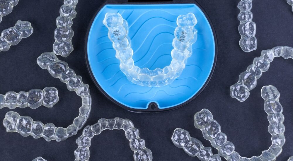 align technology