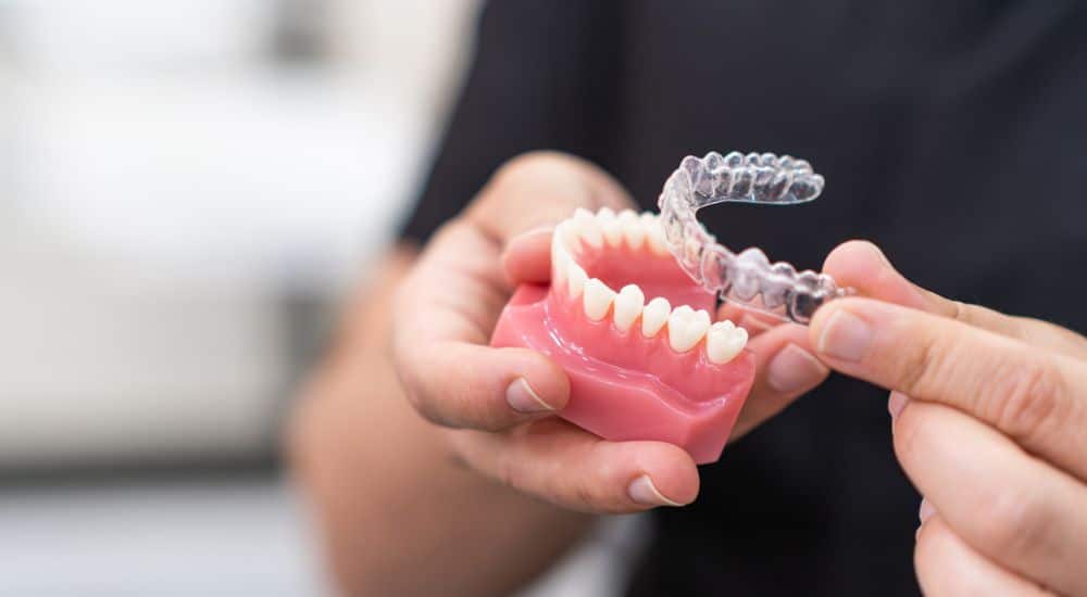 Aligneurs transparents et Coca-Cola : un impact rapide sur le pH et le microbiome