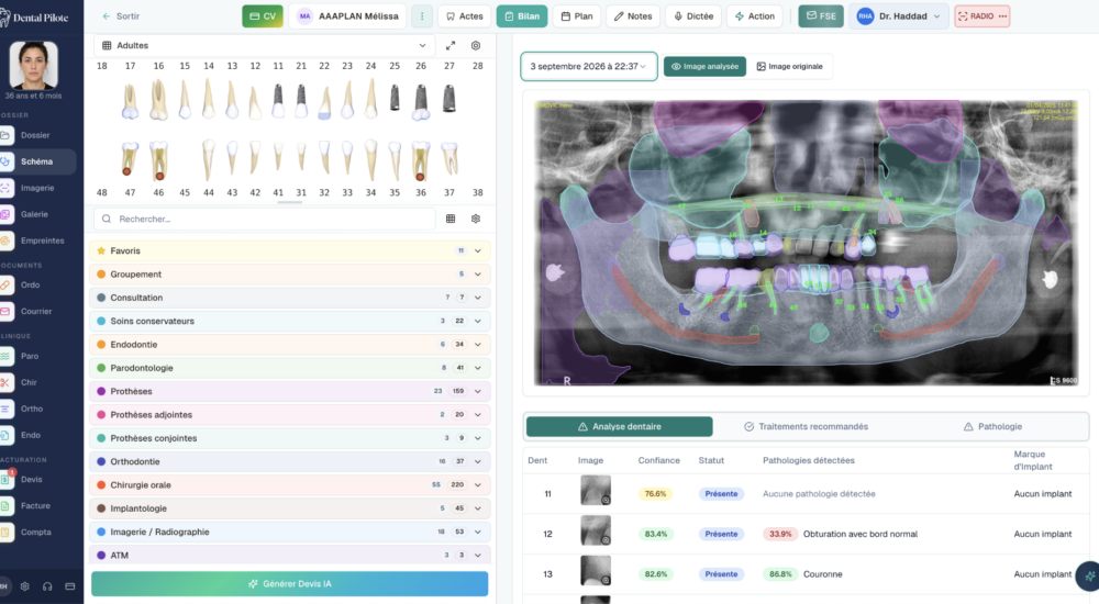 Dental Pilote : le logiciel dentaire IA pour prendre une nouvelle dimension