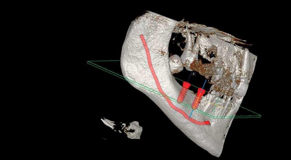 Le CBCT en omnipratique