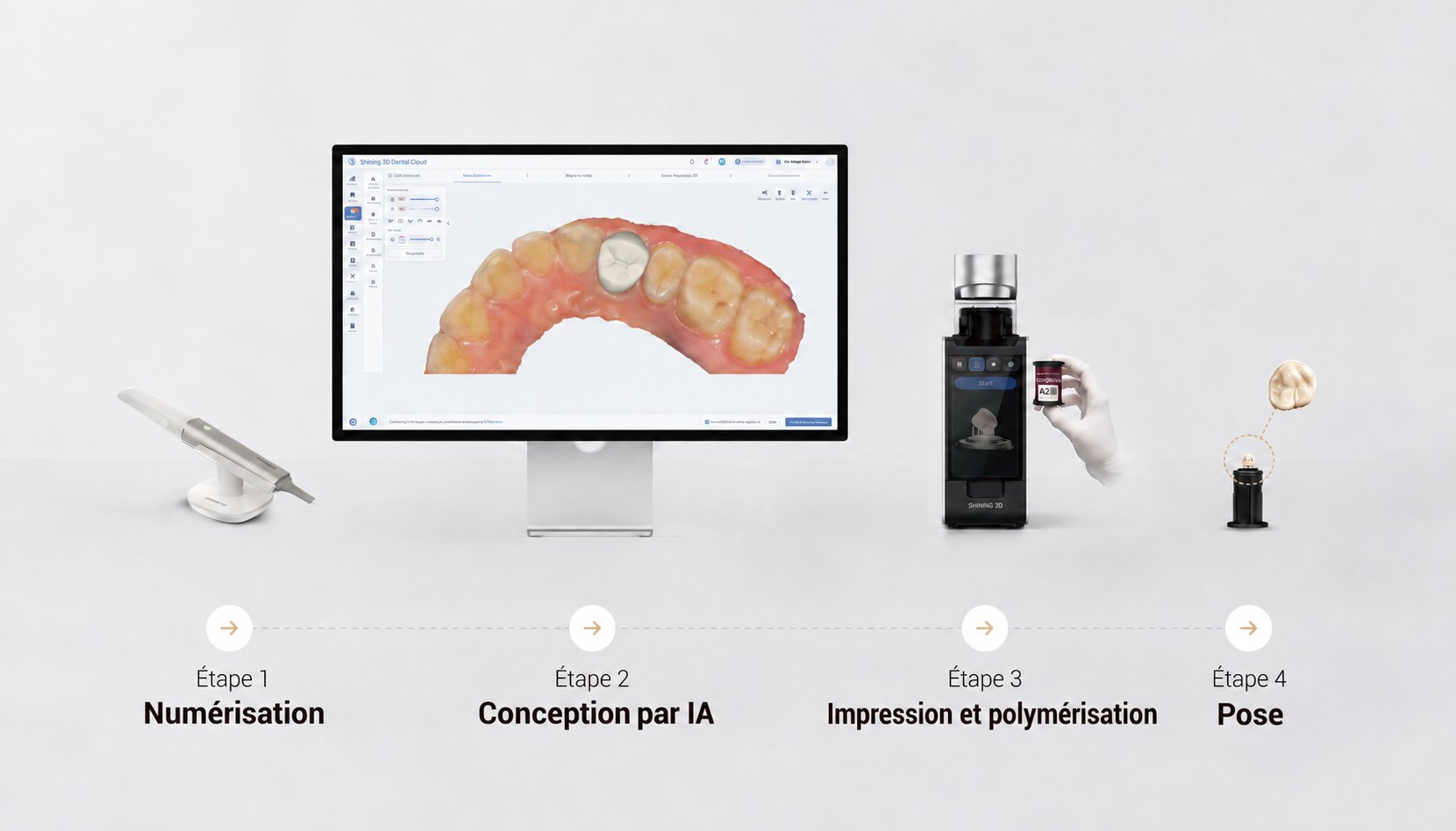 Flux numérique Ceramix-Nano en 4 étapes : numérisation, conception par IA, impression et polymérisation, pose