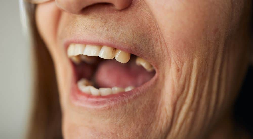 Médicament pour faire repousser les dents : le TRG-035 en essai clinique au Japon